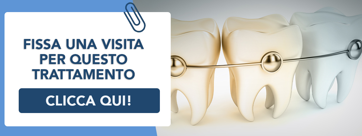 ortodonzia-prechirurgica Formia e Frattamaggiore